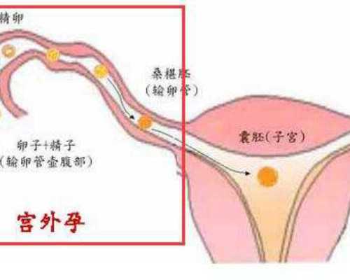 国内供卵得多少钱,二代试管婴儿包生男孩大概要多少钱，附费用一览！